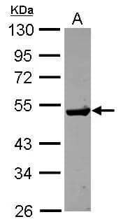 Sample (30 ug of whole cell lysate)  A: HCT116  10% SDS PAGE  NBP2-16769 diluted at 1:1000  