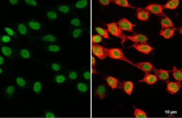 Histone H1.0 antibody detects Histone H1.0 protein at nucleus by immunofluorescent analysis.Sample: 293T cells were fixed in 4% paraformaldehyde at RT for 15 min.Green: Histone H1.0 stained by Histone H1.0 antibody (NBP2-16772) diluted at 1:500.Red: alpha Tubulin, a cytoskeleton marker, stained by alpha Tubulin antibody [GT114]  diluted at 1:1000. 