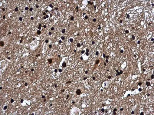 Histone H1.0 antibody detects Histone H1.0 protein at nucleus in mouse brain by immunohistochemical analysis. Sample: Paraffin-embedded mouse brain. Histone H1.0 antibody (NBP2-16772) diluted at 1:500. br>Antigen Retrieval: Citrate buffer, pH 6.0, 15 min 