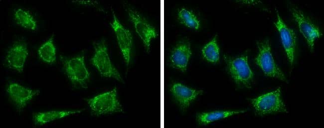 HADH antibody detects HADH protein at mitochondria by immunofluorescent analysis.Sample: HeLa cells were fixed in ice-cold MeOH for 5 min.Green: HADH protein stained by HADH antibody (NBP2-16776) diluted at 1:500.Blue: Hoechst 33342 staining. 
