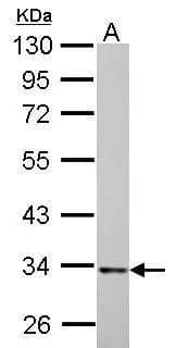 HADH antibody detects HADH protein by Western blot analysis.A. 30 ug PC-12 whole cell lysate/extract10 % SDS-PAGEHADH antibody (NBP2-16776) dilution: 1:1000 