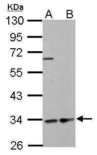 HADH antibody detects HADH protein by Western blot analysis.A. 30 ug GL261 whole cell lysate/extractB. 30 ug C8D30 whole cell lysate/extract10 % SDS-PAGEHADH antibody (NBP2-16776) dilution: 1:1000 