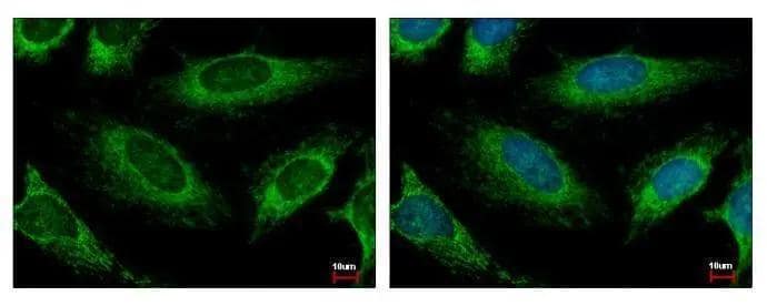 HADH antibody detects HADH protein at Mitochondria by immunofluorescent analysis. Sample: HeLa cells were fixed in 2% paraformaldehyde/culture medium at 37C for 30 min.Green: HADH protein stained by HADH antibody (NBP2-16777) diluted at 1:500.Blue: Hoechst 33343 staining. 