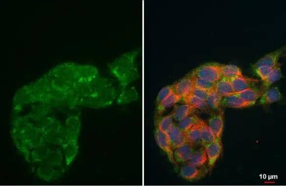 HADH antibody detects HADH protein at mitochondria by immunofluorescent analysis.Sample: HepG2 cells were fixed in 4% paraformaldehyde at RT for 15 min.Green: HADH stained by HADH antibody (NBP2-16777) diluted at 1:500.Red: alpha Tubulin, a cytoskeleton marker, stained by alpha Tubulin antibody [GT114]  diluted at 1:1000.Blue: Fluoroshield with DAPI . 
