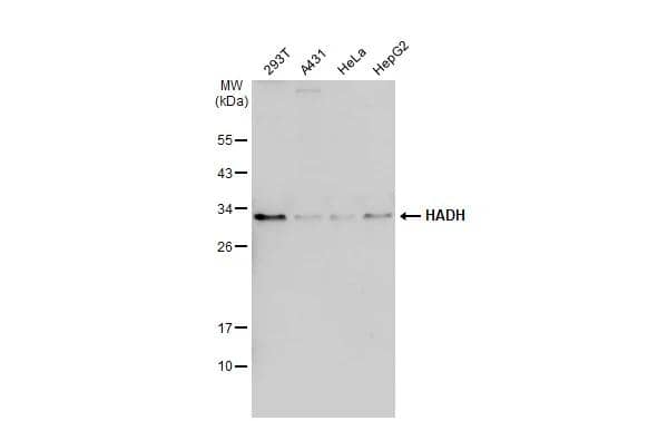 Various whole cell extracts (30 ug) were separated by 12% SDS-PAGE, and the membrane was blotted with HADH antibody (NBP2-16777) diluted at 1:1000. The HRP-conjugated anti-rabbit IgG antibody  was used to detect the primary antibody. 