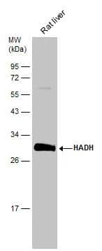 Rat tissue extract (50 ug) was separated by 12% SDS-PAGE, and the membrane was blotted with HADH antibody (NBP2-16777) diluted at 1:1000. The HRP-conjugated anti-rabbit IgG antibody  was used to detect the primary antibody. 