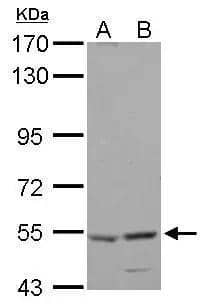 HARS antibody [N1C1] detects HARS protein by Western blot analysis.A. 30 ug HepG2 whole cell lysate/extractB. 30 ug HCT116 whole cell lysate/extract7.5 % SDS-PAGEHARS antibody [N1C1] (NBP2-16781) dilution: 1:500 