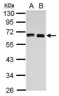 Western Blot Hyaluronan Synthase 3/HAS3 Antibody - BSA Free