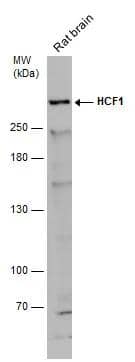 Rat tissue extract (50 ug) was separated by 5% SDS-PAGE, and the membrane was blotted with HCF1 antibody [N1], N-term (NBP2-16786) diluted at 1:500. The HRP-conjugated anti-rabbit IgG antibody  was used to detect the primary antibody. 