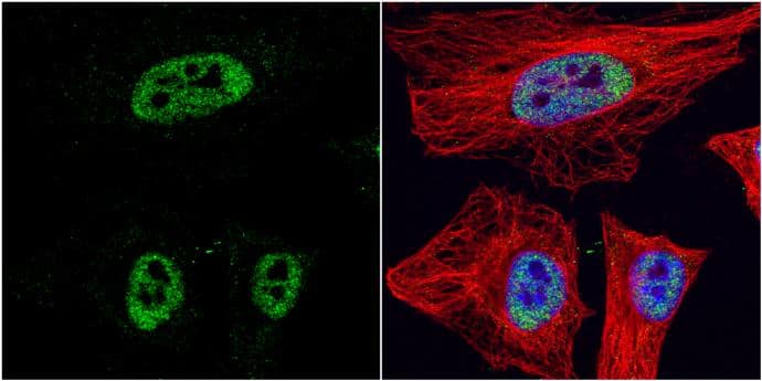 HDAC3 antibody detects HDAC3 protein at nucleus by immunofluorescent analysis.Sample: HeLa cells were fixed in 4% paraformaldehyde at RT for 15 min.Green: HDAC3 protein stained by HDAC3 antibody (NBP2-16791) diluted at 1:1000.Red: alpha Tubulin, a cytoskeleton marker, stained by alpha Tubulin antibody [GT114]  diluted at 1:1000.Blue: Hoechst 33342 staining. 