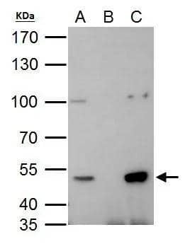 HDAC3 antibody immunoprecipitates HDAC3 protein in IP experiments. IP Sample: 293T whole cell lysate/extract A. 40 ug 293T whole cell lysate/extract B. Control with 2 ug of preimmune rabbit IgG C. Immunoprecipitation of HDAC3 protein by 2 ug of HDAC3 antibody (NBP2-16791) 7.5% SDS-PAGE The immunoprecipitated HDAC3 protein was detected by HDAC3 antibody (NBP2-16791) diluted at 1:1000. EasyBlot anti-rabbit IgG  was used as a secondary reagent. 
