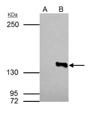 Immunoprecipitation Histone Deacetylase 4/HDAC4 Antibody - BSA Free