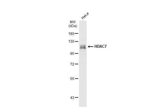 Whole cell extract (30 ug) was separated by 7.5% SDS-PAGE, and the membrane was blotted with HDAC7 antibody [C2C3], C-term (NBP2-16795) diluted at 1:1000. The HRP-conjugated anti-rabbit IgG antibody  was used to detect the primary antibody. 
