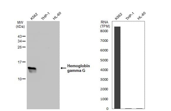 <b>Orthogonal Strategies Validation. </b>Western Blot: HBG1/2 Antibody [NBP2-16806] - Various whole cell extracts (30 ug) were separated by 15% SDS-PAGE, and the membrane was blotted with Hemoglobin gamma G antibody  diluted at 1:500. The HRP-conjugated anti-rabbit IgG antibody  was used to detect the primary antibody. Corresponding RNA expression data for the same cell lines are based on Human Protein Atlas program.