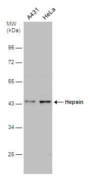 Various whole cell extracts (30 ug) were separated by 10% SDS-PAGE, and the membrane was blotted with Hepsin antibody (NBP2-16808) diluted at 1:500. 