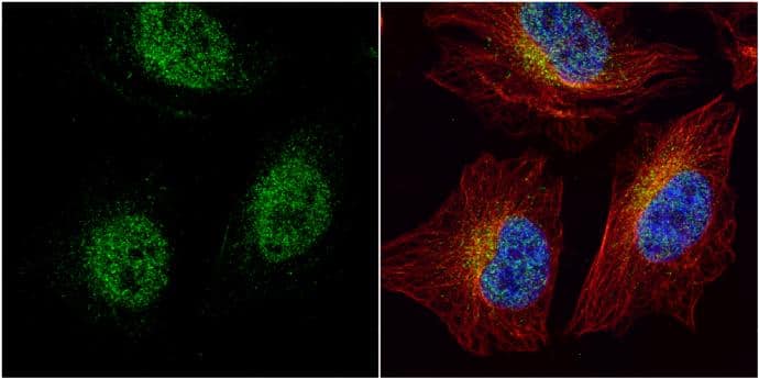 HEY1 antibody detects HEY1 protein at cytoplasm and nucleus by immunofluorescent analysis.Sample: HeLa cells were fixed in 4% paraformaldehyde at RT for 15 min.Green: HEY1 protein stained by HEY1 antibody (NBP2-16818) diluted at 1:2000.Red: alpha Tubulin, a cytoskeleton marker, stained by alpha Tubulin antibody [GT114]  diluted at 1:1000.Blue: Hoechst 33342 staining. 