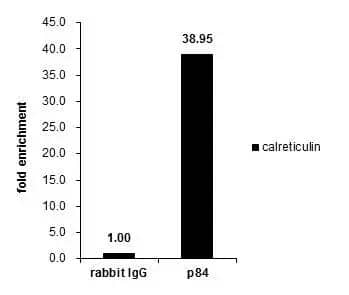 Cross-linked ChIP was performed with HeLa chromatin extract and 5 ug of either control rabbit IgG or anti-Nuclear Matrix Protein p84 antibody. The precipitated DNA was detected by PCR with primer set targeting to calreticulin. 