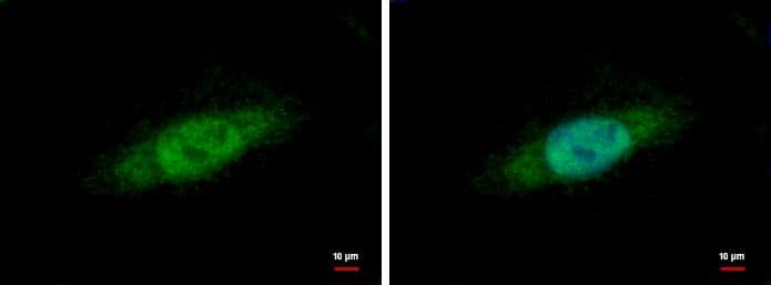 Nuclear Matrix Protein p84 antibody [C1C3] detects Nuclear Matrix Protein p84 protein at cytoplasm and nucleus by immunofluorescent analysis.Sample: HeLa cells were fixed in 4% paraformaldehyde at RT for 15 min.Green: Nuclear Matrix Protein p84 protein stained by Nuclear Matrix Protein p84 antibody [C1C3] (NBP2-16822) diluted at 1:500.Blue: Hoechst 33342 staining. 