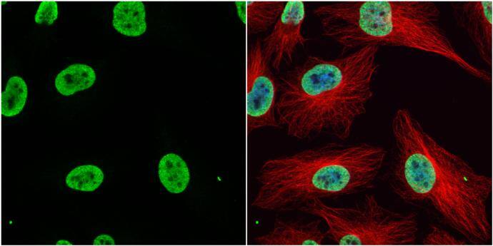 Histone H3K9K14ac (acetyl Lys9/Lys14) antibody detects Histone H3K9K14ac (acetyl Lys9/Lys14) protein at nucleus by immunofluorescent analysis.Sample: HeLa cells were fixed in 4% paraformaldehyde at RT for 15 min.Green: Histone H3K9K14ac (acetyl Lys9/Lys14) protein stained by Histone H3K9K14ac (acetyl Lys9/Lys14) antibody (NBP2-16837) diluted at 1:1000.Red: alpha Tubulin, a cytoskeleton marker, stained by alpha Tubulin antibody [GT114]  diluted at 1:1000.Blue: Hoechst 33342 staining. 