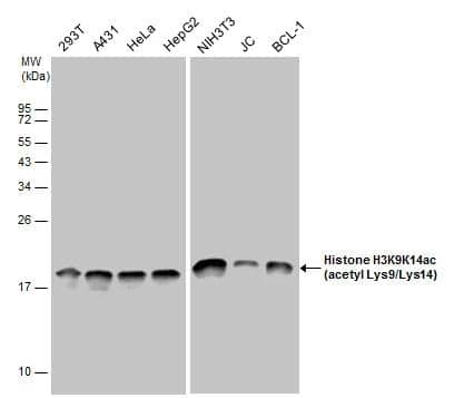 <b>Biological Strategies Validation. </b>Histone H3K9K14ac (acetyl Lys9/Lys14) antibody detects Histone H3K9K14ac (acetyl Lys9/Lys14) protein by western blot analysis. Various whole cell extracts (30 ug) were separated by 12% SDS-PAGE, and the membrane was blotted with Histone H3K9K14ac (acetyl Lys9/Lys14) antibody (NBP2-16837) diluted at a dilution of 1:10000. The HRP-conjugated anti-rabbit IgG antibody  was used to detect the primary antibody. 