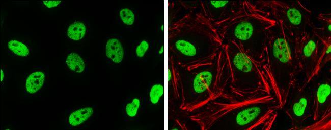 Histone H3K4me2 (dimethyl Lys4) antibody detects Histone H3K4me2 (dimethyl Lys4) protein at nucleus by immunofluorescent analysis.Sample: HeLa cells were fixed in 4% paraformaldehyde at RT for 15 min.Green: Histone H3K4me2 (dimethyl Lys4) protein stained by Histone H3K4me2 (dimethyl Lys4) antibody (NBP2-16838) diluted at 1:1000.Red: phalloidin, a cytoskeleton marker, diluted at 1:50. 