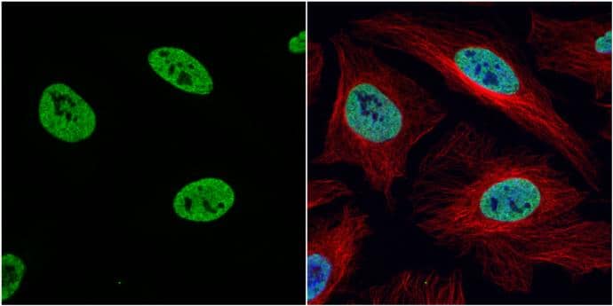 Histone H3K4me2 (dimethyl Lys4) antibody detects Histone H3K4me2 (dimethyl Lys4) protein at nucleus by immunofluorescent analysis.Sample: HeLa cells were fixed in 4% paraformaldehyde at RT for 15 min.Green: Histone H3K4me2 (dimethyl Lys4) protein stained by Histone H3K4me2 (dimethyl Lys4) antibody (NBP2-16838) diluted at 1:1000.Red: alpha Tubulin, a cytoskeleton marker, stained by alpha Tubulin antibody [GT114]  diluted at 1:1000.Blue: Hoechst 33342 staining. 