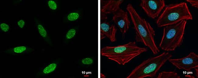Histone H3K9me3 (trimethyl Lys9) antibody detects Histone H3K9me3 (trimethyl Lys9) protein at nucleus by immunofluorescent analysis.Sample: HeLa cells were fixed in 4% paraformaldehyde at RT for 15 min.Green: Histone H3K9me3 (trimethyl Lys9) protein stained by Histone H3K9me3 (trimethyl Lys9) antibody (NBP2-16841) diluted at 1:500.Red: Phalloidin, a cytoskeleton marker, diluted at 1:200.Blue: Hoechst 33342 staining.Scale bar = 10 um. 