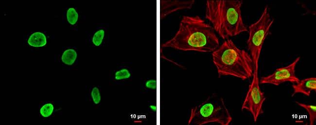 Histone H4K5K8K12K16ac (acetyl Lys5/Lys8/Lys12/Lys16) antibody detects Histone H4K5K8K12K16ac (acetyl Lys5/Lys8/Lys12/Lys16) protein at nucleus by immunofluorescent analysis.Sample: HeLa cells were fixed in 4% paraformaldehyde at RT for 15 min.Green: Histone H4K5K8K12K16ac (acetyl Lys5/Lys8/Lys12/Lys16) protein stained by Histone H4K5K8K12K16ac (acetyl Lys5/Lys8/Lys12/Lys16) antibody (NBP2-16848) diluted at 1:500.Red: phalloidin, a cytoskeleton marker, diluted at 1:200.Scale bar = 10 um. 