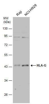 Various whole cell extracts (30 ug) were separated by 10% SDS-PAGE, and the membrane was blotted with HLA-G antibody (NBP2-16855) diluted at 1:500. 