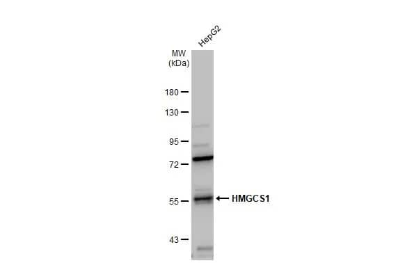 Western Blot: HMGCS1 Antibody [NBP2-16861] - Whole cell extract (30 ug) was separated by 7.5% SDS-PAGE, and the membrane was blotted with HMGCS1 antibody (NBP2-16861) diluted at 1:5000. The HRP-conjugated anti-rabbit IgG antibody  was used to detect the primary antibody.