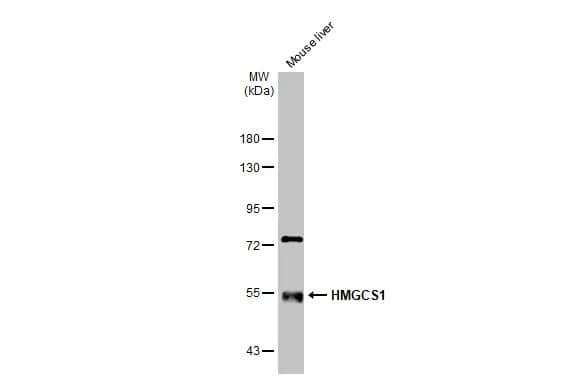 Western Blot: HMGCS1 Antibody [NBP2-16861] - Mouse tissue extract (50 ug) was separated by 7.5% SDS-PAGE, and the membrane was blotted with HMGCS1 antibody (NBP2-16861) diluted at 1:1000. The HRP-conjugated anti-rabbit IgG antibody  was used to detect the primary antibody.