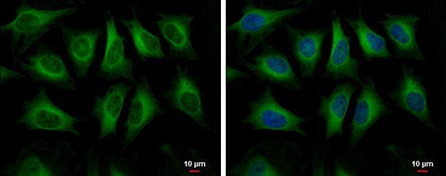HMGCS1 antibody detects HMGCS1 protein at cytoplasm by immunofluorescent analysis.Sample: HeLa cells were fixed in 4% paraformaldehyde at RT for 15 min.Green: HMGCS1 protein stained by HMGCS1 antibody (NBP2-16861) diluted at 1:500.Blue: Hoechst 33342 staining.Scale bar = 10 um. 