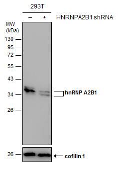 <b>Genetic Strategies Validation. </b>Non-transfected (-) and transfected (+) 293T whole cell extracts (30 ug) were separated by 12% SDS-PAGE, and the membrane was blotted with hnRNP A2B1 antibody (NBP2-16864) diluted at 1:5000. 