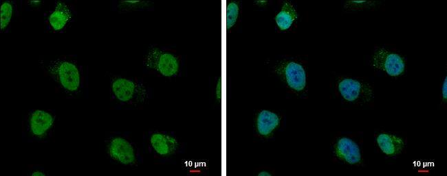 hnRNP A/B antibody detects hnRNP A/B protein at nucleus by immunofluorescent analysis.Sample: HeLa cells were fixed in 4% paraformaldehyde at RT for 15 min.Green: hnRNP A/B protein stained by hnRNP A/B antibody (NBP2-16865) diluted at 1:500.Blue: Hoechst 33342 staining.Scale bar = 10 um. 