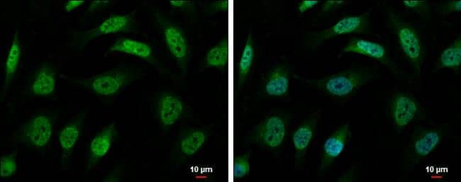 hnRNP R antibody [N1N2], N-term detects hnRNP R protein at nucleus and cytoplasm by immunofluorescent analysis.Sample: HeLa cells were fixed in 4% paraformaldehyde at RT for 15 min.Green: hnRNP R protein stained by hnRNP R antibody [N1N2], N-term (NBP2-16868) diluted at 1:500.Blue: Hoechst 33342 staining.Scale bar = 10 um. 