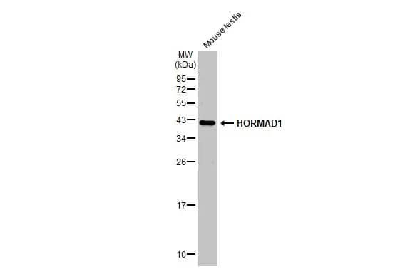 Western Blot: HORMAD1 Antibody [NBP2-16869] - Mouse tissue extract (50 ug) was separated by 12% SDS-PAGE, and the membrane was blotted with HORMAD1 antibody [N2C2], Internal (NBP2-16869) diluted at 1:1000. The HRP-conjugated anti-rabbit IgG antibody  was used to detect the primary antibody.