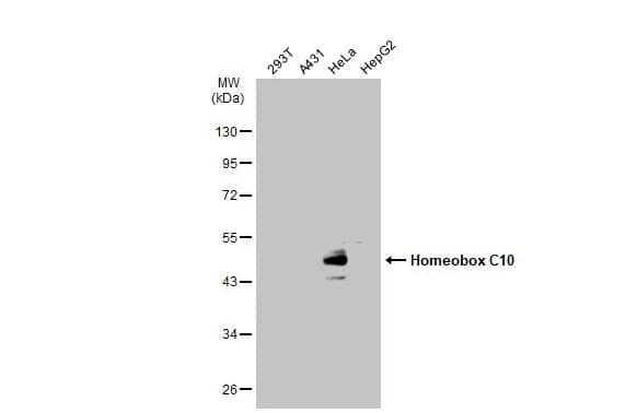 Western Blot: HOXC10 Antibody [NBP2-16874] - Various whole cell extracts (30 ug) were separated by 10% SDS-PAGE, and the membrane was blotted with HOXC10 antibody (NBP2-16874) diluted at 1:1000. The HRP-conjugated anti-rabbit IgG antibody  was used to detect the primary antibody.