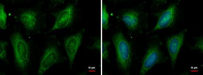 HSC70 antibody detects HSC70 protein at cytoplasm by immunofluorescent analysis.Sample: HeLa cells were fixed in ice-cold MeOH for 5 min.Green: HSC70 protein stained by HSC70 antibody (NBP2-16882) diluted at 1:500.Blue: Hoechst 33342 staining. 