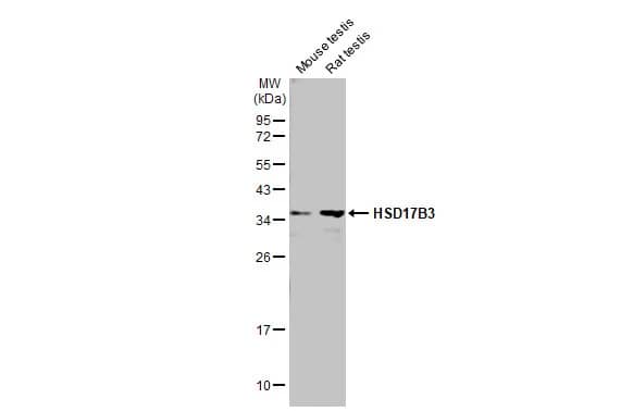 Western Blot: HSD17B3 Antibody [NBP2-16884] - Various tissue extracts (50 ug) were separated by 12% SDS-PAGE, and the membrane was blotted with HSD17B3 antibody (NBP2-16884) diluted at 1:500. The HRP-conjugated anti-rabbit IgG antibody  was used to detect the primary antibody.