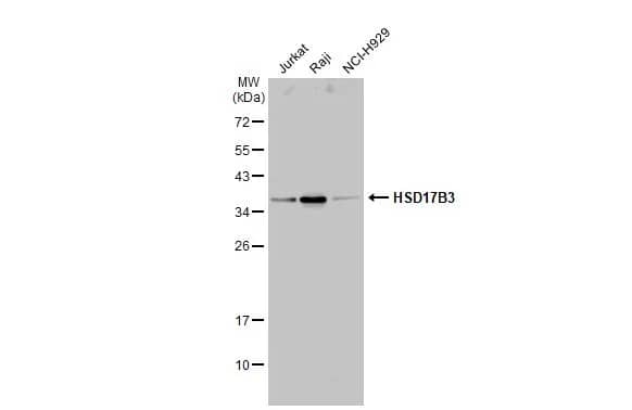 Western Blot HSD17B3 Antibody