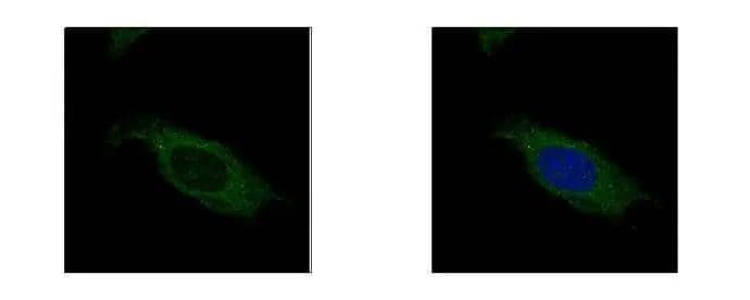 HSD17B3 antibody detects HSD17B3 protein at cytoplasm by confocal immunofluorescent analysis. Sample: HeLa cells were fixed in ice-cold MeOH for 5 min.Green: HSD17B3 protein stained by HSD17B3 antibody (NBP2-16884) diluted at 1:500.Blue: Hoechst 33342 staining.[Images captured by Olympus FV10i Confocal Laser Scanning Microscope] 