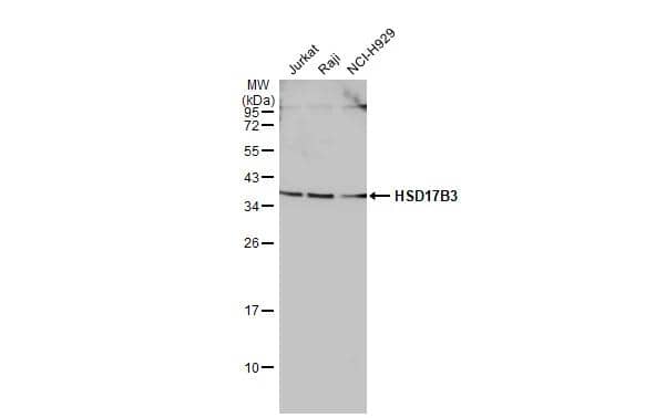 Western Blot HSD17B3 Antibody