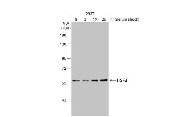 Western Blot: HSF2 Antibody [NBP2-16886] - Untreated (-) and treated (+) 293T whole cell extracts (30 ug) were separated by 7.5% SDS-PAGE, and the membrane was blotted with HSF2 antibody [N1N3] (NBP2-16886) diluted at 1:1000. The HRP-conjugated anti-rabbit IgG antibody  was used to detect the primary antibody.