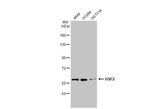 Western Blot: HSF2 Antibody [NBP2-16886] - Various whole cell extracts (30 ug) were separated by 7.5% SDS-PAGE, and the membrane was blotted with HSF2 antibody [N1N3] (NBP2-16886) diluted at 1:1000. The HRP-conjugated anti-rabbit IgG antibody  was used to detect the primary antibody.