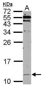 Sample (50 ug of whole cell lysate)  A: mouse brain  15% SDS PAGE  NBP2-16889 diluted at 1:500  