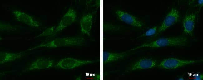 Cpn10 antibody detects Cpn10 protein at mitochondria by immunofluorescent analysis.Sample: SKNSH cells were fixed in 2% paraformaldehyde/culture medium at 37C for 15 min.Green: Cpn10 protein stained by Cpn10 antibody (NBP2-16890) diluted at 1:500.Blue: Hoechst 33342 staining. 