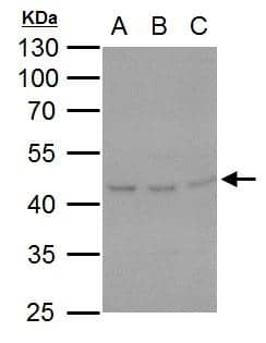 HSP47 antibody [N2C2], Internal detects HSP47 protein by western blot analysis.A. 30 ug A431 whole cell lysate/extract B. 30 ug HeLa whole cell lysate/extract C. 30 ug HepG2 whole cell lysate/extract10% SDS-PAGEHSP47 antibody [N2C2], Internal (NBP2-16893) dilution: 1:500 The HRP-conjugated anti-rabbit IgG antibody  was used to detect the primary antibody. 