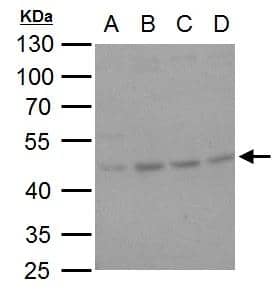 HSP47 antibody [N2C2], Internal detects HSP47 protein by western blot analysis.A. 30 ug U87-MG whole cell lysate/extract B. 30 ug SK-N-SH whole cell lysate/extract C. 30 ug IMR32 whole cell lysate/extract D. 30 ug SK-N-AS whole cell lysate/extract10% SDS-PAGEHSP47 antibody [N2C2], Internal (NBP2-16893) dilution: 1:500 The HRP-conjugated anti-rabbit IgG antibody  was used to detect the primary antibody. 