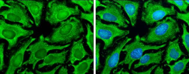 Immunocytochemistry/ Immunofluorescence HSP90 alpha Antibody