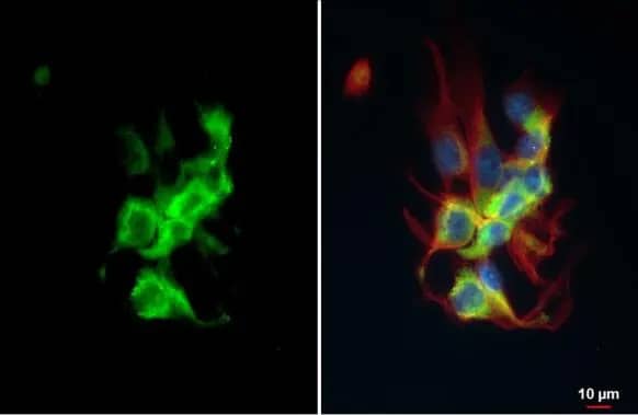 Immunocytochemistry/ Immunofluorescence: HspA1B Antibody [NBP2-16896] - HspA1B antibody detects HspA1B protein at cytoplasm by immunofluorescent analysis.Sample: U87-MG cells were fixed in 4% paraformaldehyde at RT for 15 min.Green: HspA1B stained by HspA1B antibody (NBP2-16896) diluted at 1:500.Red: alpha Tubulin, a cytoskeleton marker, stained by alpha Tubulin antibody [GT114]  diluted at 1:1000.Blue: Fluoroshield with DAPI .